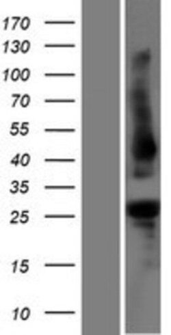 Novus Biologicals&trade;&nbsp;PLEKHB1/PHR1 Overexpression Lysate