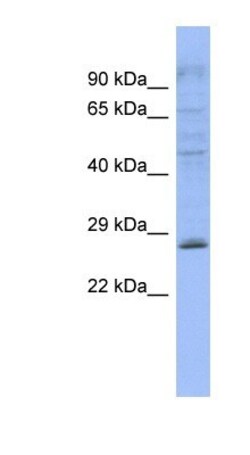 PLEKHB2 Antibody, Novus Biologicals™