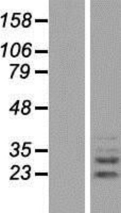 Novus Biologicals™ PLEKHF2 Overexpression Lysate