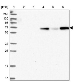 PLEKHG6 Antibody, Novus Biologicals 25 &mu;L; Unlabeled:Antibodies, Polyclonal