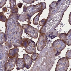 PLEKHG6 Antibody, Novus Biologicals 25 &mu;L; Unlabeled:Antibodies, Polyclonal