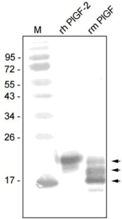 PLGF Antibody, Novus Biologicals 0.025 mg; Unconjugated:Antibodies, Polyclonal