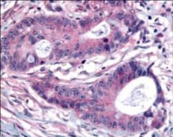 PLK1, p Thr210 Antibody, Novus Biologicals 0.1mg; Unlabeled:Antibodies,