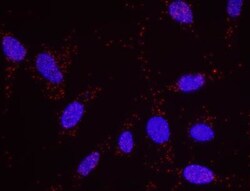 PLK1 Antibody, Novus Biologicals 0.1mg; Unlabeled:Antibodies, Polyclonal