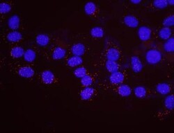 PLK1 Antibody, Novus Biologicals 0.1mg; Unlabeled:Antibodies, Polyclonal