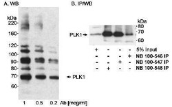 PLK1 Antibody, Novus Biologicals 0.1mg; Unlabeled:Antibodies, Polyclonal