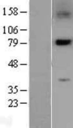 Novus Biologicals™ PLK2 Overexpression Lysate