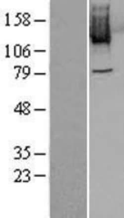 Novus Biologicals&trade;&nbsp;PLK4 Overexpression Lysate
