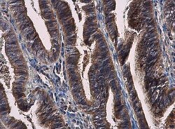 PLK4 Antibody, Novus Biologicals 0.1mL; Unlabeled:Antibodies, Polyclonal