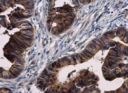 PLK4 Antibody, Novus Biologicals 0.1mL; Unlabeled:Antibodies, Polyclonal