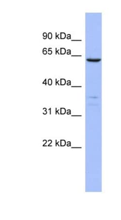 PLS1 Antibody, Novus Biologicals 100&mu;L; Unlabeled:Antibodies, Polyclonal