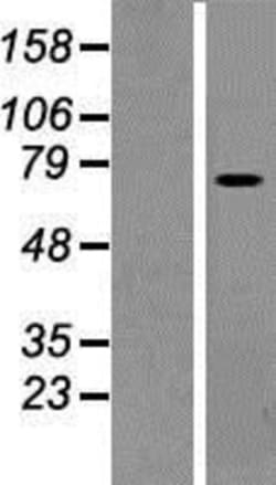 Novus Biologicals&trade;&nbsp;PLS1 Overexpression Lysate