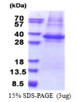 Novus Biologicals&trade;&nbsp;Recombinant Human PLSCR3 His Protein