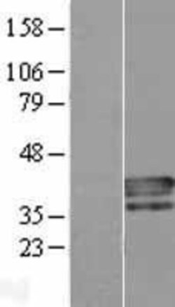 Novus Biologicals&trade;&nbsp;PLSCR4 Overexpression Lysate