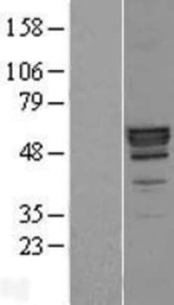 Novus Biologicals™ PLTP Overexpression Lysate