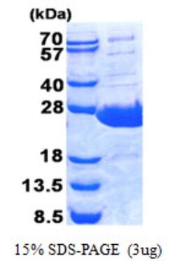 Novus Biologicals&trade;&nbsp;Recombinant Human PLUNC His Protein