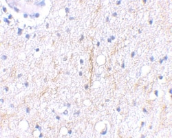 Plxdc2 Antibody - BSA Free, Novus Biologicals 0.025 mg | Buy Online | Novus Biologicals | Fisher Scientific