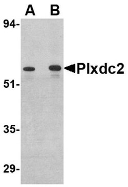 Plxdc2 Antibody - BSA Free, Novus Biologicals 0.025 mg | Buy Online | Novus Biologicals | Fisher Scientific