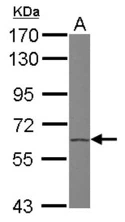 PLZF Antibody, Novus Biologicals 0.1mL; Unlabeled:Antibodies, Polyclonal