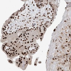PM20D2 Antibody, Novus Biologicals 0.1mL; Unlabeled:Antibodies, Polyclonal
