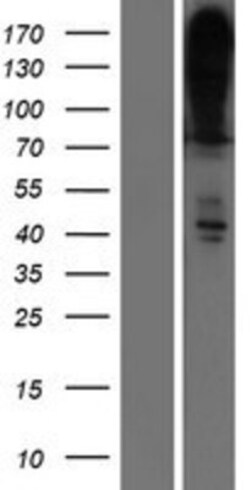 Novus Biologicals&trade;&nbsp;PMCA4 Overexpression Lysate
