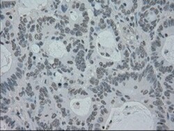 PMEL17/SILV Antibody (OTI10E5), Novus Biologicals 0.1mL; Unlabeled:Antibodies,