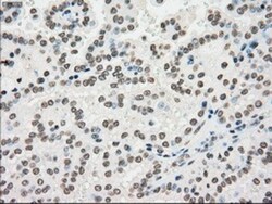 PMEL17/SILV Antibody (OTI10E5), Novus Biologicals 0.1mL; Unlabeled:Antibodies,