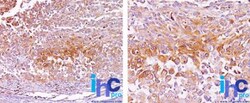 PMEL17/SILV Antibody (NKI-beteb), Novus Biologicals:Antibodies:Primary
