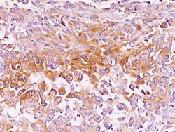 PMEL17/SILV Antibody (NKI-beteb), Novus Biologicals:Antibodies:Primary