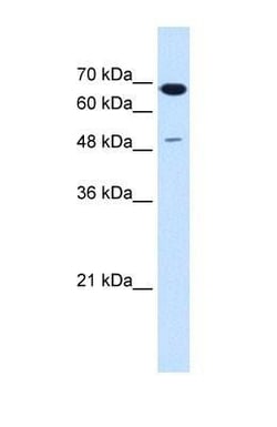 PMEL17/SILV Antibody, Novus Biologicals 0.1mg; Unlabeled:Antibodies, Polyclonal