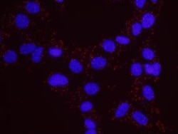 PML Protein Antibody - BSA Free, Novus Biologicals:Antibodies:Primary Antibodies