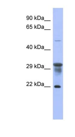 PMM1/Phosphomannomutase 1 Antibody, Novus Biologicals:Antibodies:Primary