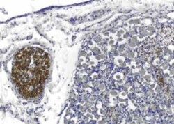 PMP22 Antibody (Hu1), Novus Biologicals 0.1mL; Unlabeled:Antibodies, Monoclonal