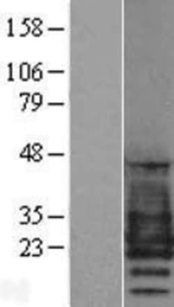 Novus Biologicals&trade;&nbsp;PMP22 Overexpression Lysate