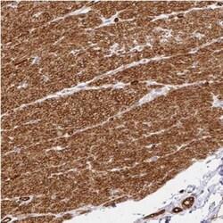 SLC25A17 Antibody, Novus Biologicals 25 &mu;L, Unlabeled:Antibodies, Polyclonal