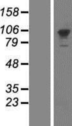 Novus Biologicals&trade;&nbsp;PMS2 Overexpression Lysate
