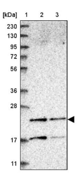 PMVK/phosphomevalonate kinase Antibody, Novus Biologicals 0.1mL; Unlabeled:Antibodies,