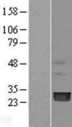 Novus Biologicals™ PMVK/phosphomevalonate kinase Overexpression Lysate
