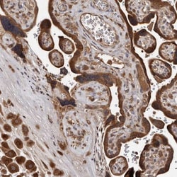 PMVK/phosphomevalonate kinase Antibody, Novus Biologicals 0.1mL; Unlabeled:Antibodies,