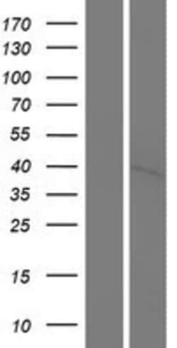 Novus Biologicals™ PNCK Overexpression Lysate