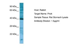 PNCK Antibody, Novus Biologicals 100&mu;L; Unlabeled:Antibodies, Polyclonal
