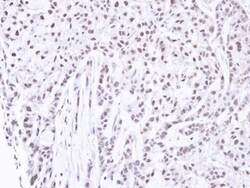 PNK Antibody, Novus Biologicals 0.1mg; Unlabeled:Antibodies, Polyclonal