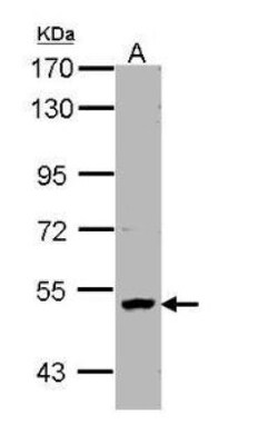 PNK Antibody, Novus Biologicals 0.1mg; Unlabeled:Antibodies, Polyclonal