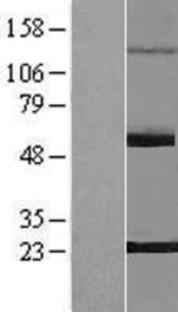 Novus Biologicals&trade;&nbsp;PNLDC1 Overexpression Lysate