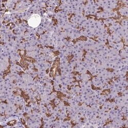 PNLDC1 Antibody, Novus Biologicals 0.1mL; Unlabeled:Antibodies, Polyclonal