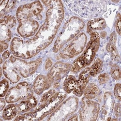 PNLIPRP3 Antibody, Novus Biologicals:Antibodies:Primary Antibodies