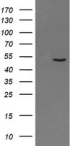 PNMA3 Antibody (OTI2E6), Novus Biologicals 0.1 mL | Buy Online | Novus Biologicals | Fisher Scientific