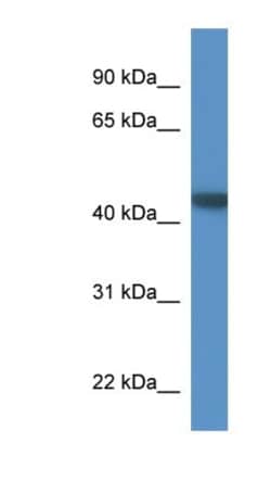 PNMA6A Antibody, Novus Biologicals 100&mu;L; Unlabeled:Antibodies, Polyclonal