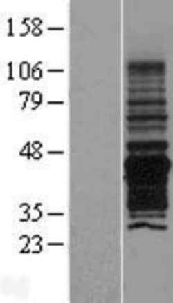 Novus Biologicals™ PNMA6A Overexpression Lysate