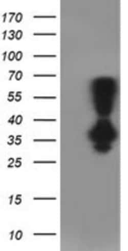 PNMT Antibody (OTI1D2), Novus Biologicals 0.1 mL | Buy Online | Novus Biologicals | Fisher Scientific